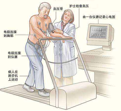 冠心病需要做哪些檢查？(圖3)